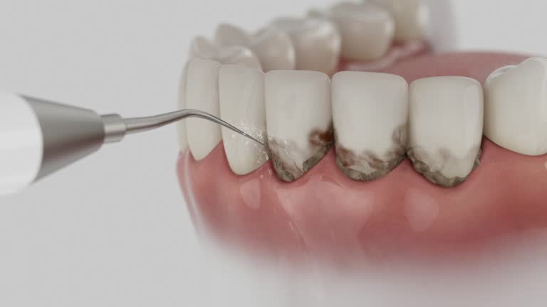 Reliable Dental Implants contractor in Brookfield, WI by Smile Center Dentistry